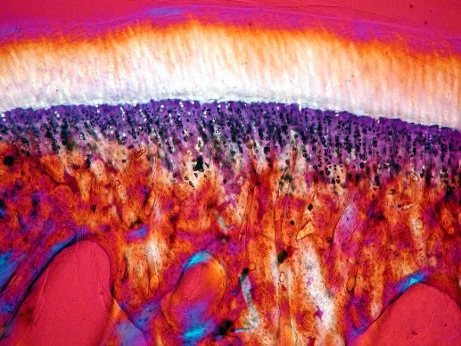 Cartilage articulaire © Inserm/Chappard, Daniel Cartilage articulaire